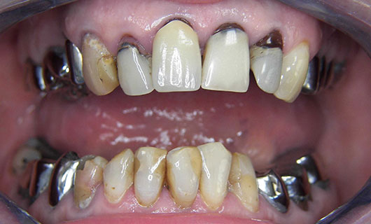 dentiste Blavozy 43