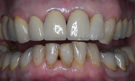 dentiste Blavozy 43